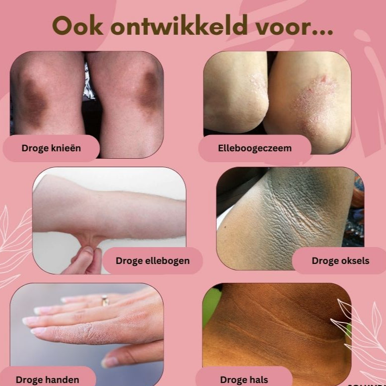 1+1 GRATIS | FootGlow™ - Voetherstellende crème