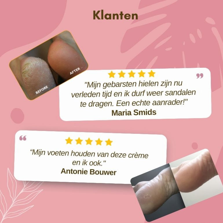 1+1 GRATIS | FootGlow™ - Voetherstellende crème