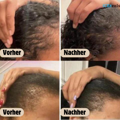 1+1 GRATIS | Veganic™ - Natürliches Haarwuchsöl