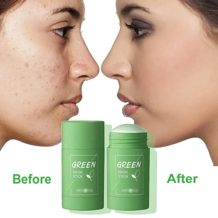 1+1 GRATIS | CleanSkin™ – Strahlende Haut in 15 Minuten ohne Reizungen!