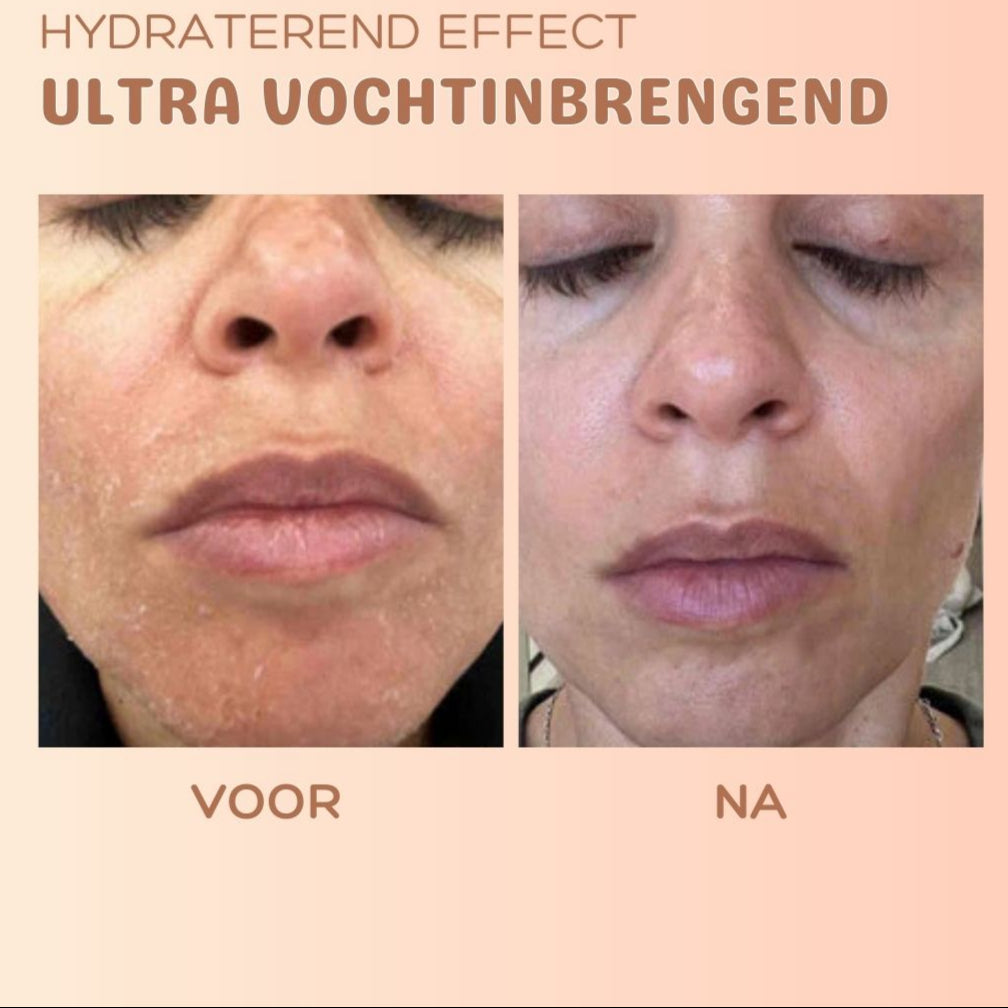1+1 GRATIS | SilkTouch™ - Anti-rimpel huidvernieuwingsbalsem