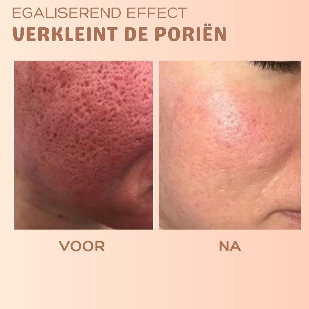 1+1 GRATIS | SilkTouch™ - Anti-rimpel huidvernieuwingsbalsem