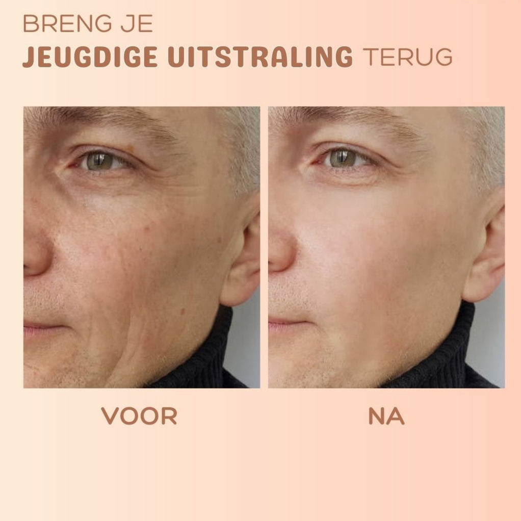 1+1 GRATIS | SilkTouch™ - Anti-rimpel huidvernieuwingsbalsem