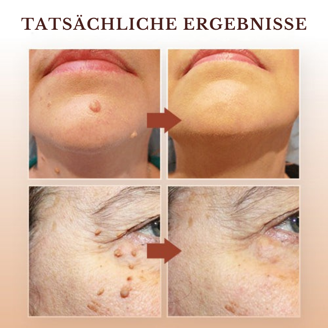1+1 GRATIS | ClearRadiance™ — Entfernt Hautanhängsel schnell für einen glatten, selbstbewussten Teint
