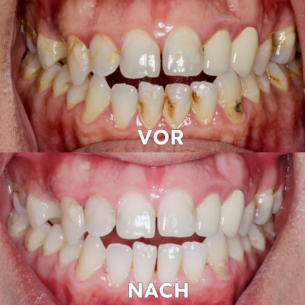 CocoBreathe™ | Kokosöl-Mundspülung für frischen Atem und antibakterielle Wirkung