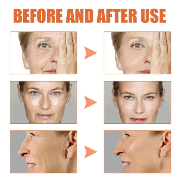 1+1 GRATIS | GlowTox™ | Glatte, jugendliche Haut mit Botox Anti-Aging Serum
