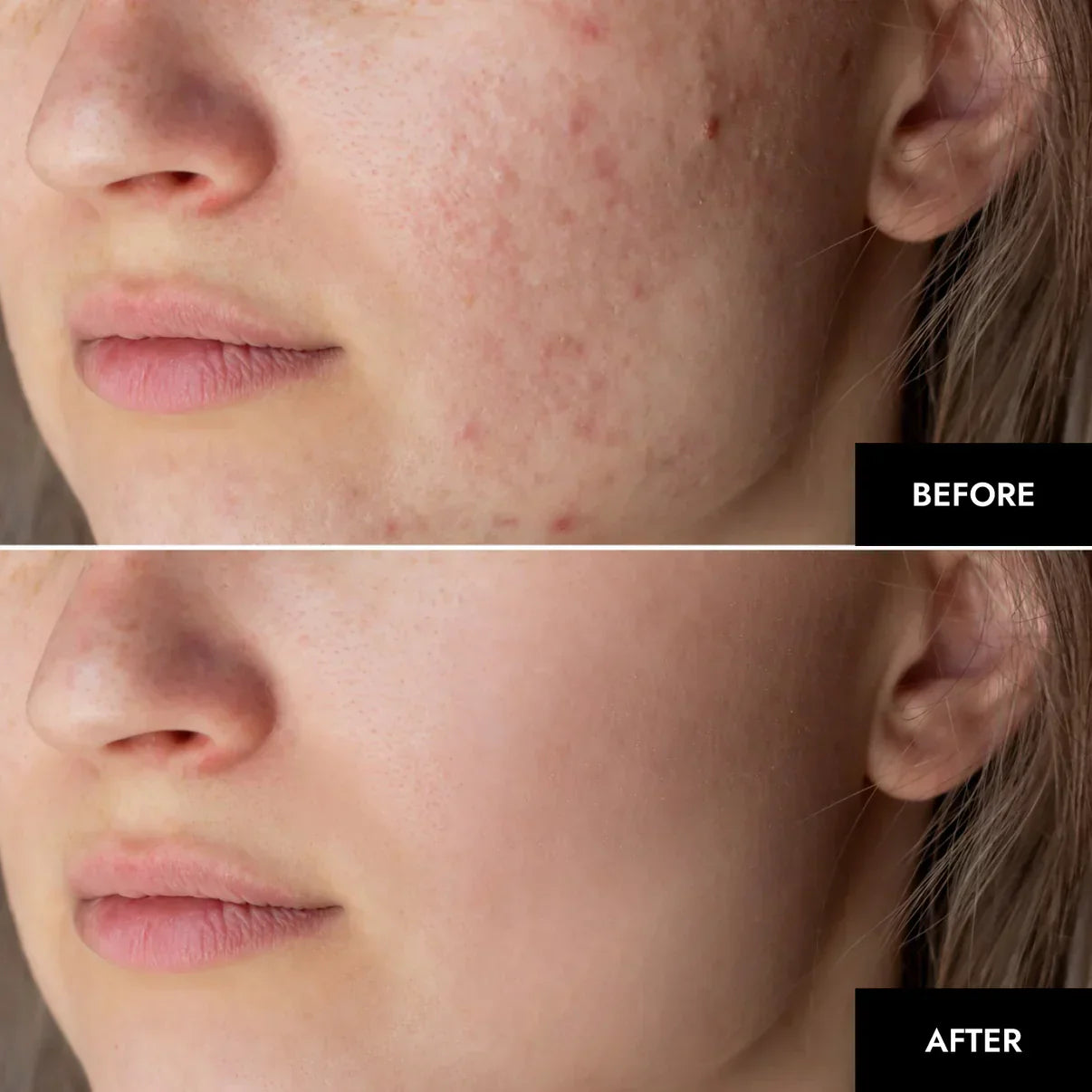 1+1 GRATIS | GlowSkin™ Sofort glattere Haut