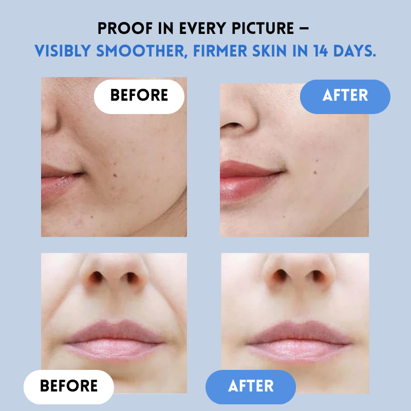 LiftDefine® | Anti-Aging-Streifen