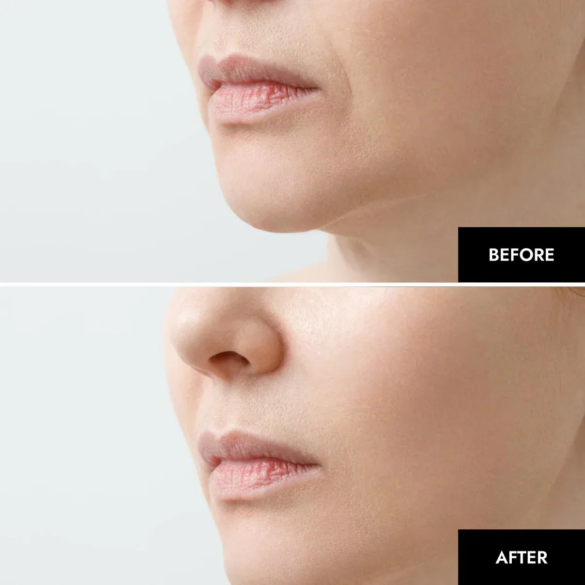 1+1 GRATIS | GlowSkin™ Sofort glattere Haut
