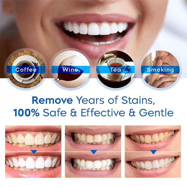 1+1 GRATIS | TeethPro® | Fleckenentfernende Aufhellungsessenz
