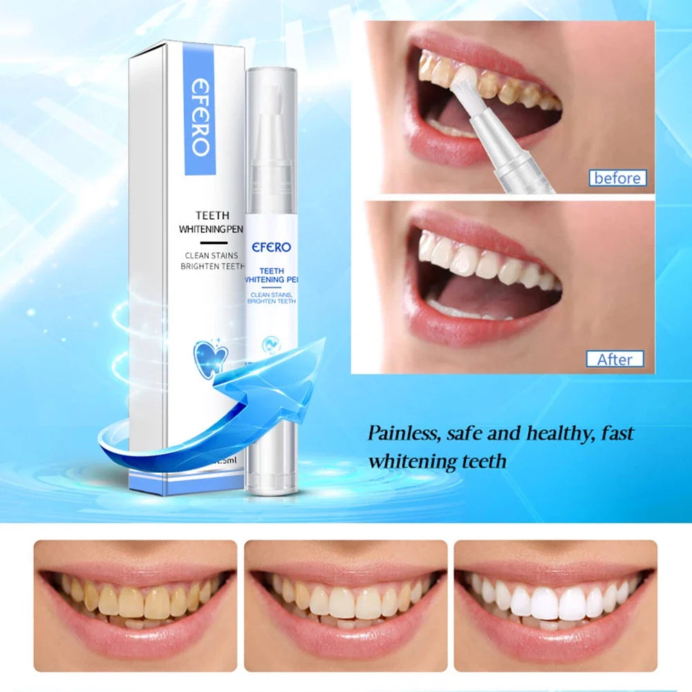EFERO Zahnaufhellungsstift – entfernt Verfärbungen, reinigt Flecken und hellt Zähne auf, 5 ml Teeth Whitening Pen für ein strahlendes Lächeln