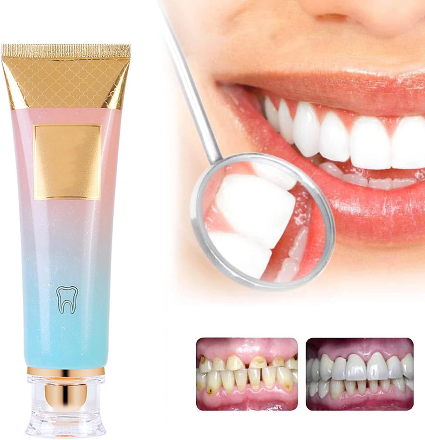 1+1 GRATIS | BrightSmile™ - Aufhellung ohne Empfindlichkeit