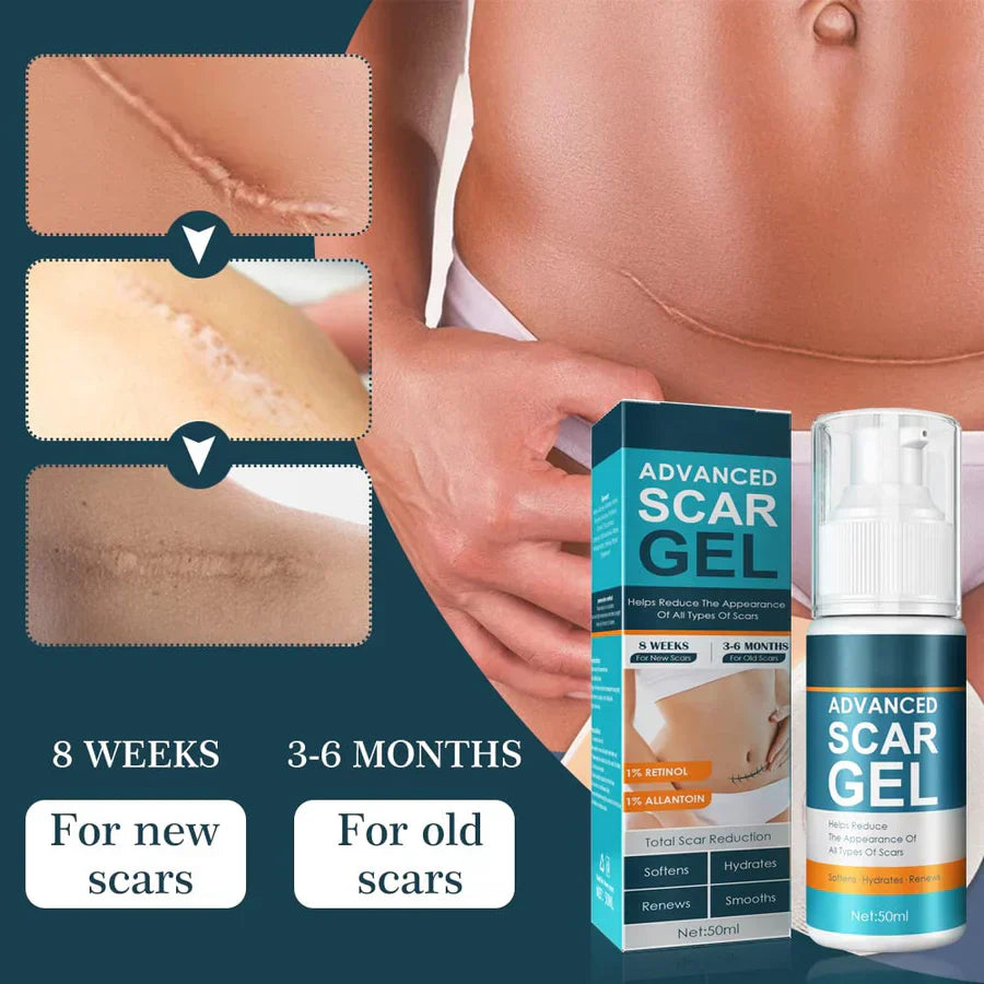 1+1 GRATIS | ScarErase™ Narben schön verblassen lassen