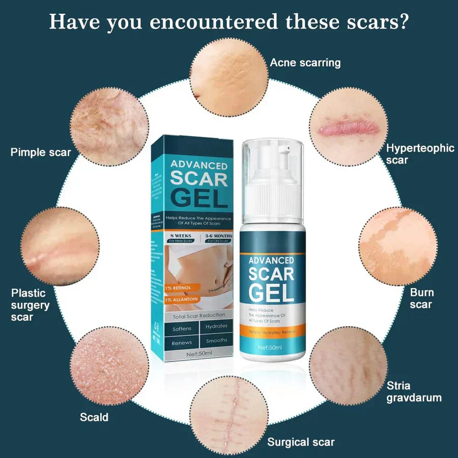 1+1 GRATIS | ScarGel™ | Narben verblassen schön.