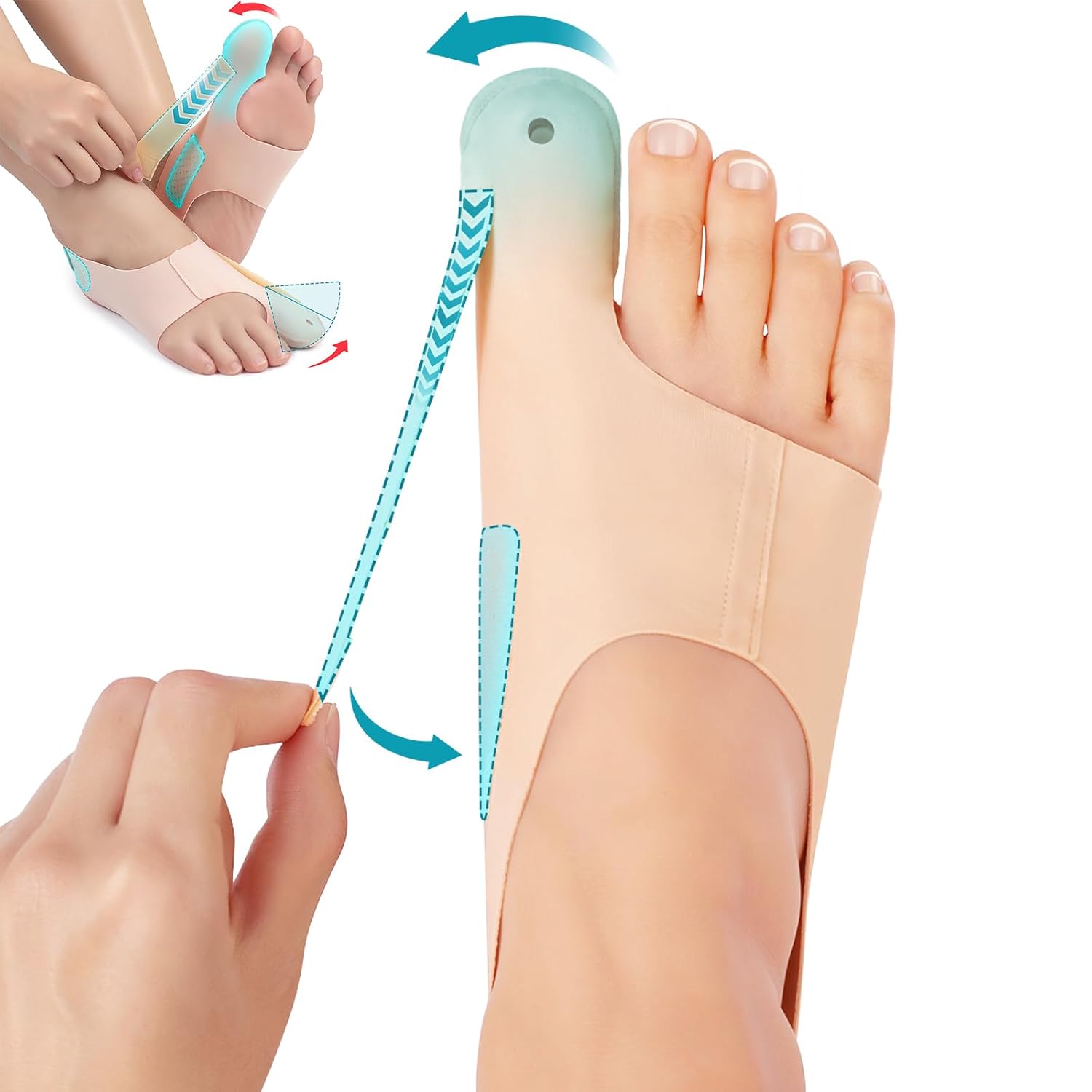 Hallux Valgus Zehenspreizer und Fußbandage zur Korrektur von Ballenzehen