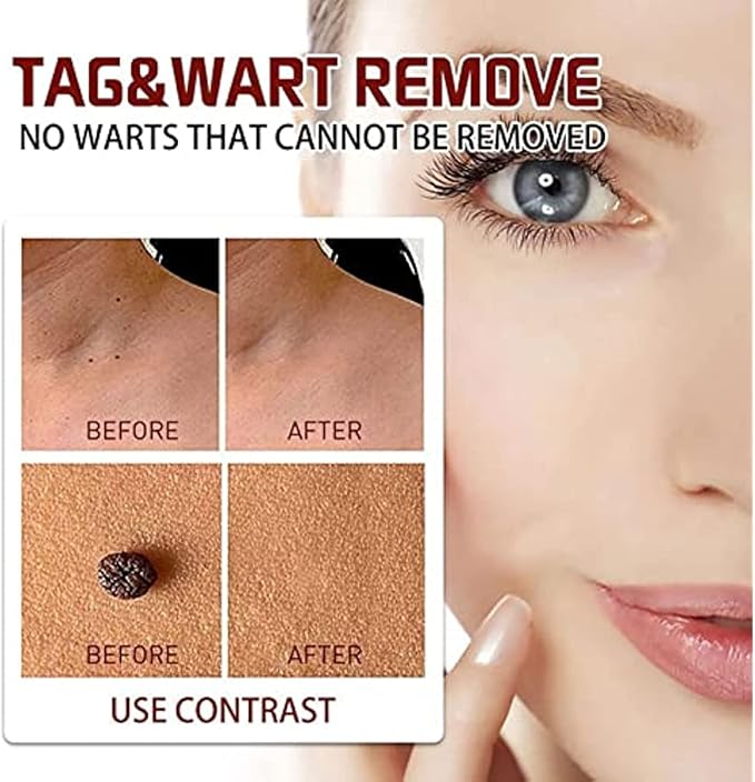 1+1 GRATIS | SpotWipe™ Entfesseln Sie makellose Ausstrahlung!