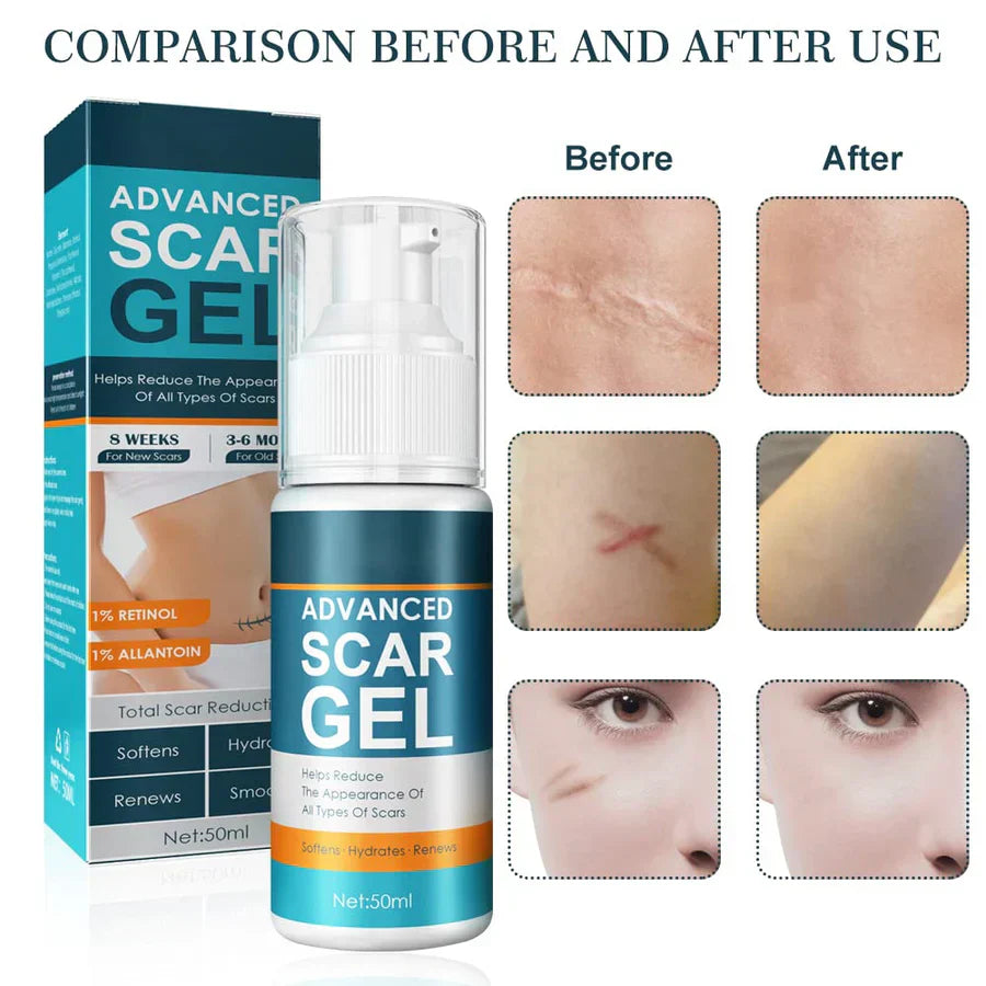 1+1 GRATIS | ScarGel™ | Narben verblassen schön.