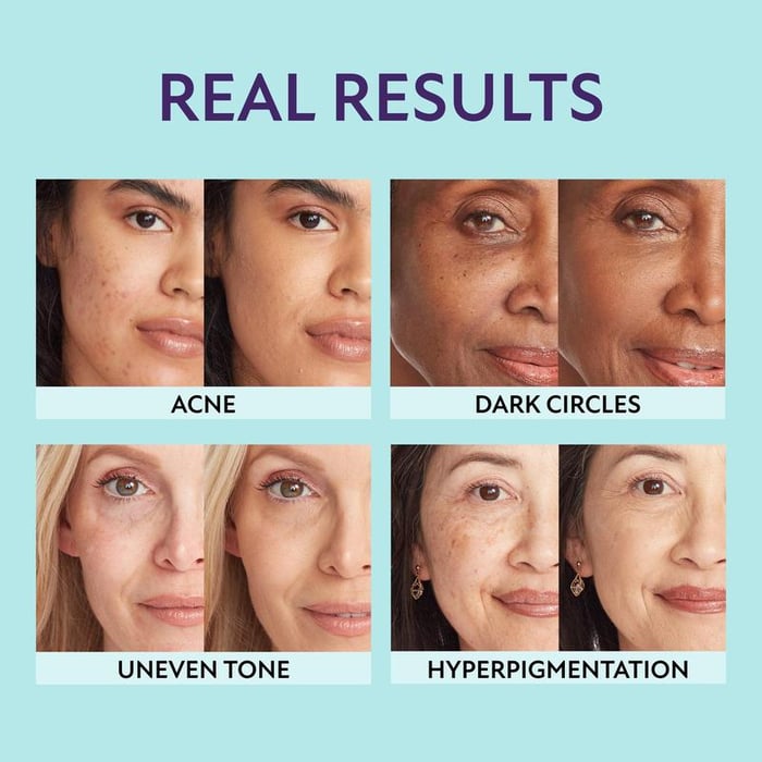 GlowFusion® | Feuchtigkeitsspendender Concealer
