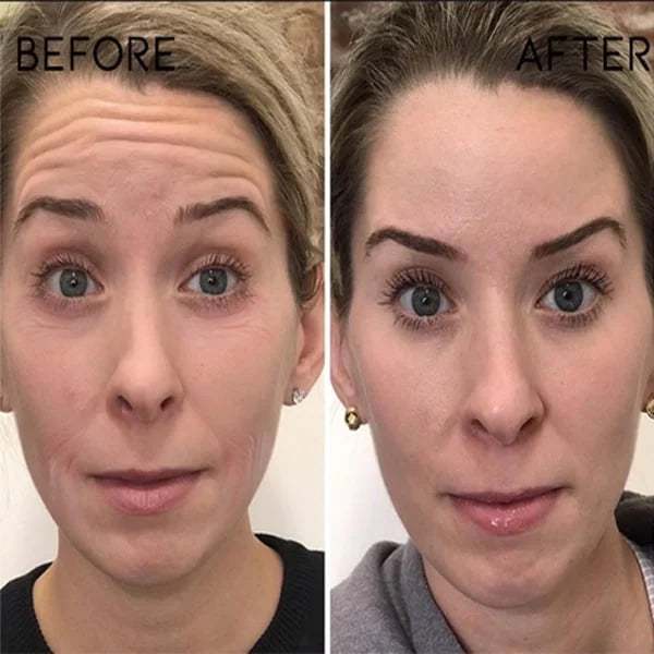 1+1 GRATIS | GlowTox™ | Glatte, jugendliche Haut mit Botox Anti-Aging Serum