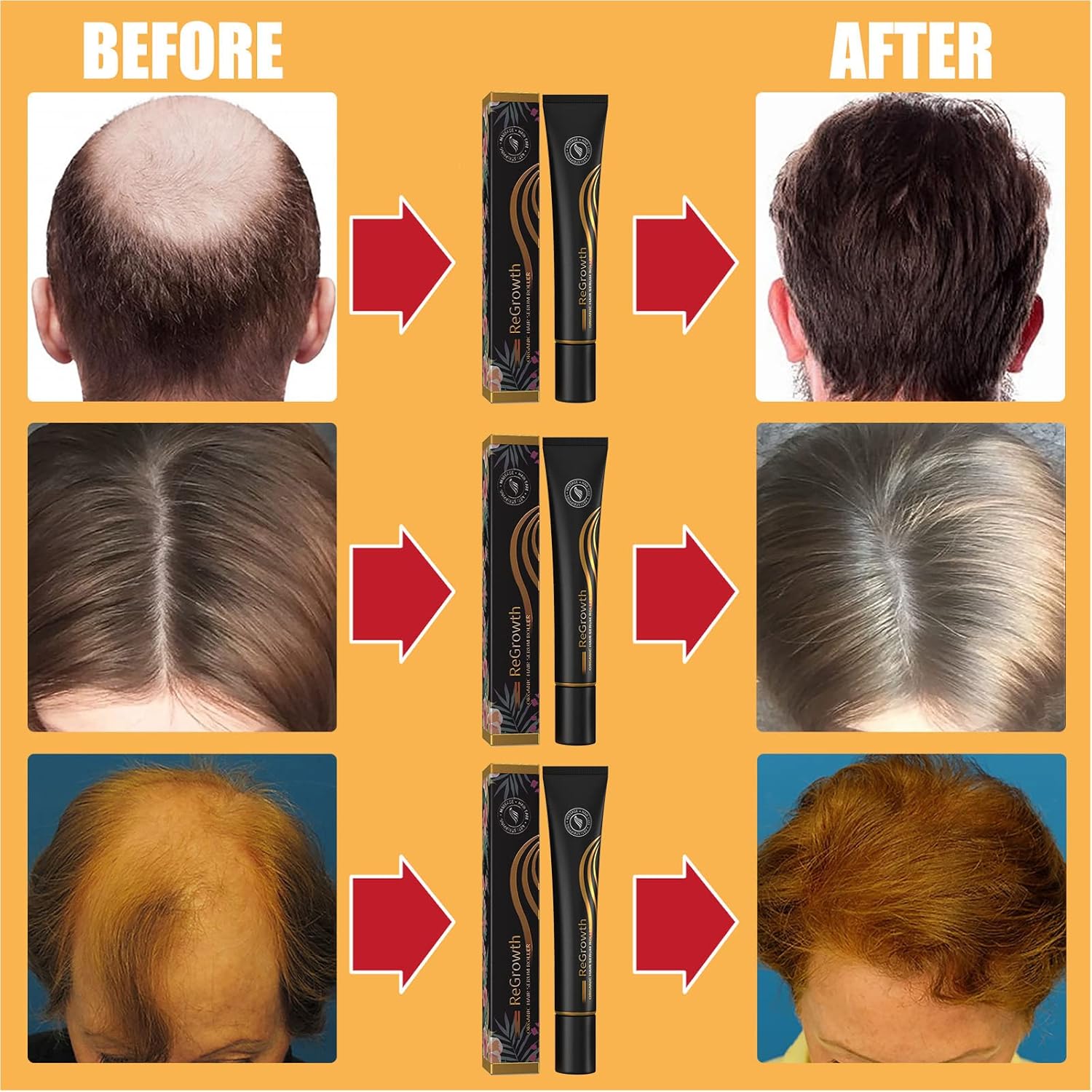 1+1 GRATIS | RootRevive™ Bio-Haarpflege