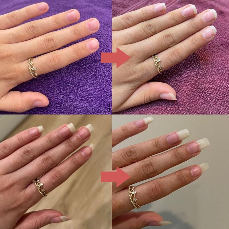 1+1 GRATIS | Nailuxe™ | Für starke and gesunde Nägel