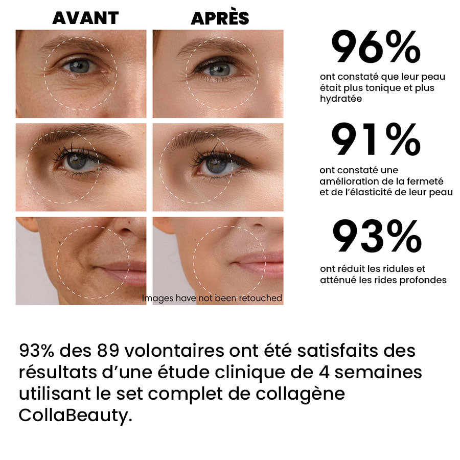 1+1 GRATIS | CollaBeauty™ – Komplettes Set mit löslichem Kollagen