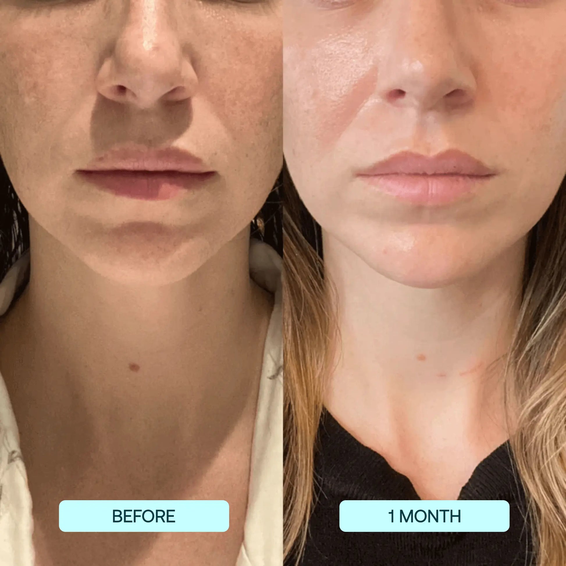 1+1 GRATIS | GlowSkin™ Sofort glattere Haut
