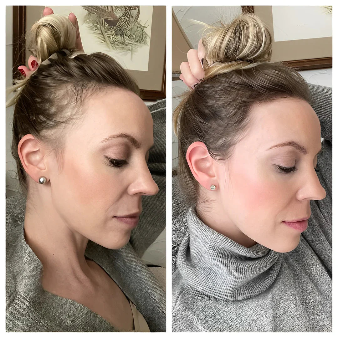 1+1 GRATIS | RegrowBar™ | Anti-Haarausfall