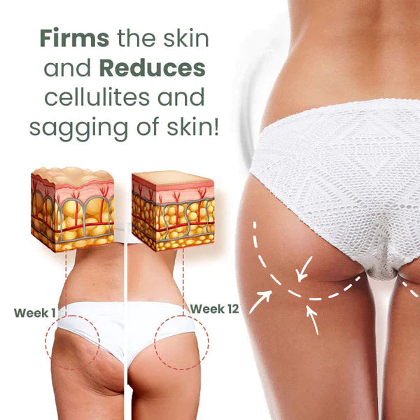 1+1 Gratis | CelluVanish™ Fortschrittliche Anti-Cellulite-Straffungscreme