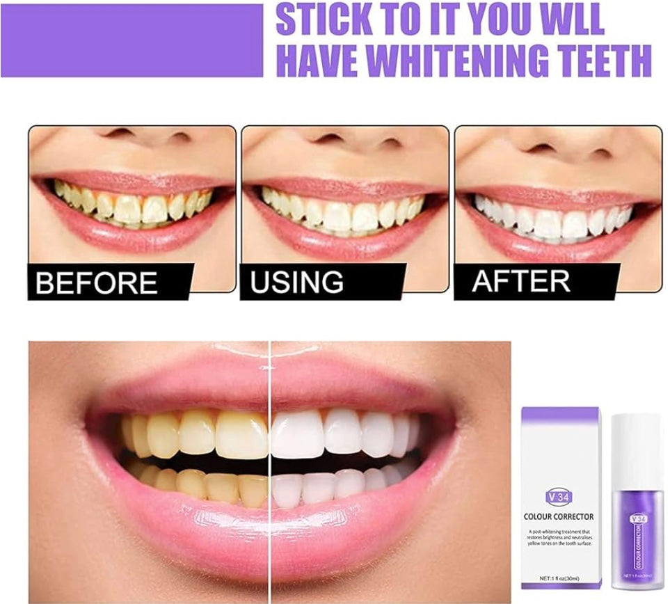 1+1 GRATIS | PureSmile® | Zahnaufhellungsset für ein strahlendes, langanhaltendes Lächeln