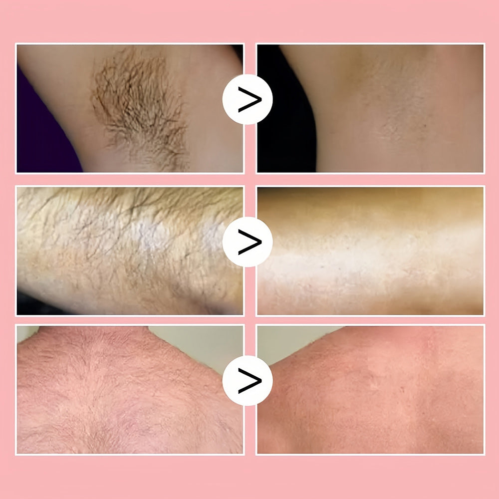 1+1 GRATIS | Honey Mousse Hair Removal Spray™ | Für eine makellose und haarfreie Haut!