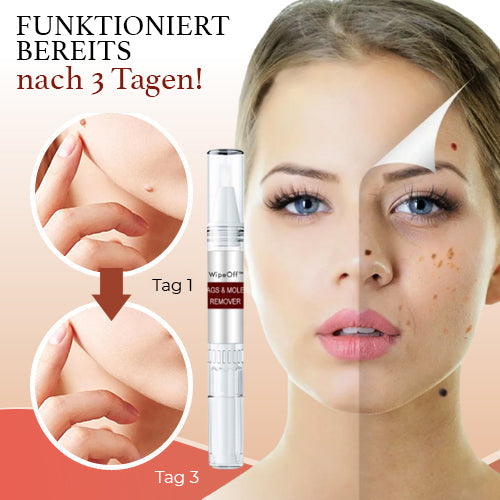 1+1 GRATIS | WipeOff® | Professionelles Werkzeug zur Entfernung von Muttermalen