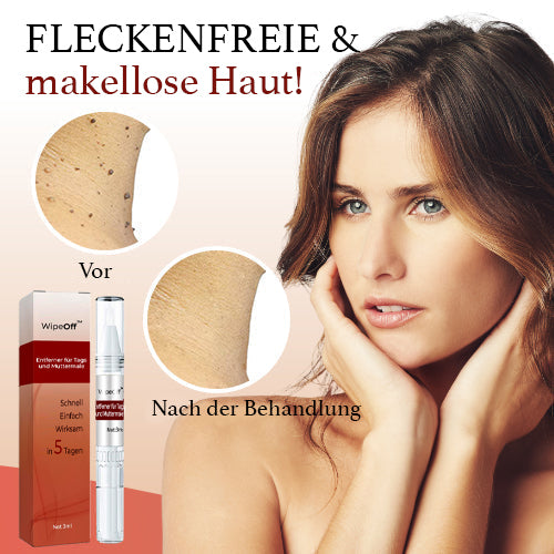 Hautentferner für Tags und Muttermale – wirksame und einfache Behandlung in 5 Tagen, 3ml Präzisionsstift
