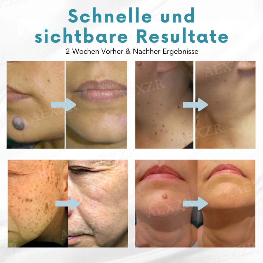 1+1 GRATIS | RadiantDefy™ Schnelle Hautverjüngung