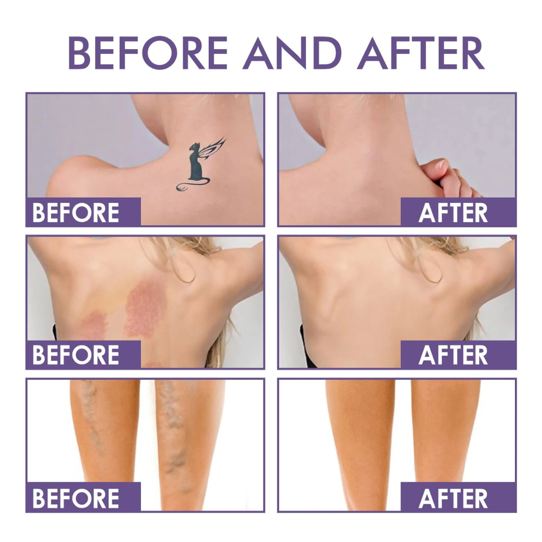 50% RABATT TEMPORÄR | DermaVelle™ | Makellose Haut in Sekundenschnelle - ganz ohne Filter!