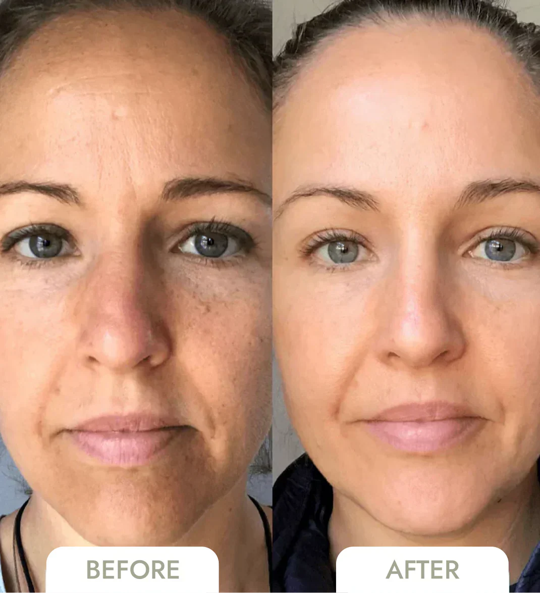 1+1 GRATIS | GlowSkin™ Sofort glattere Haut
