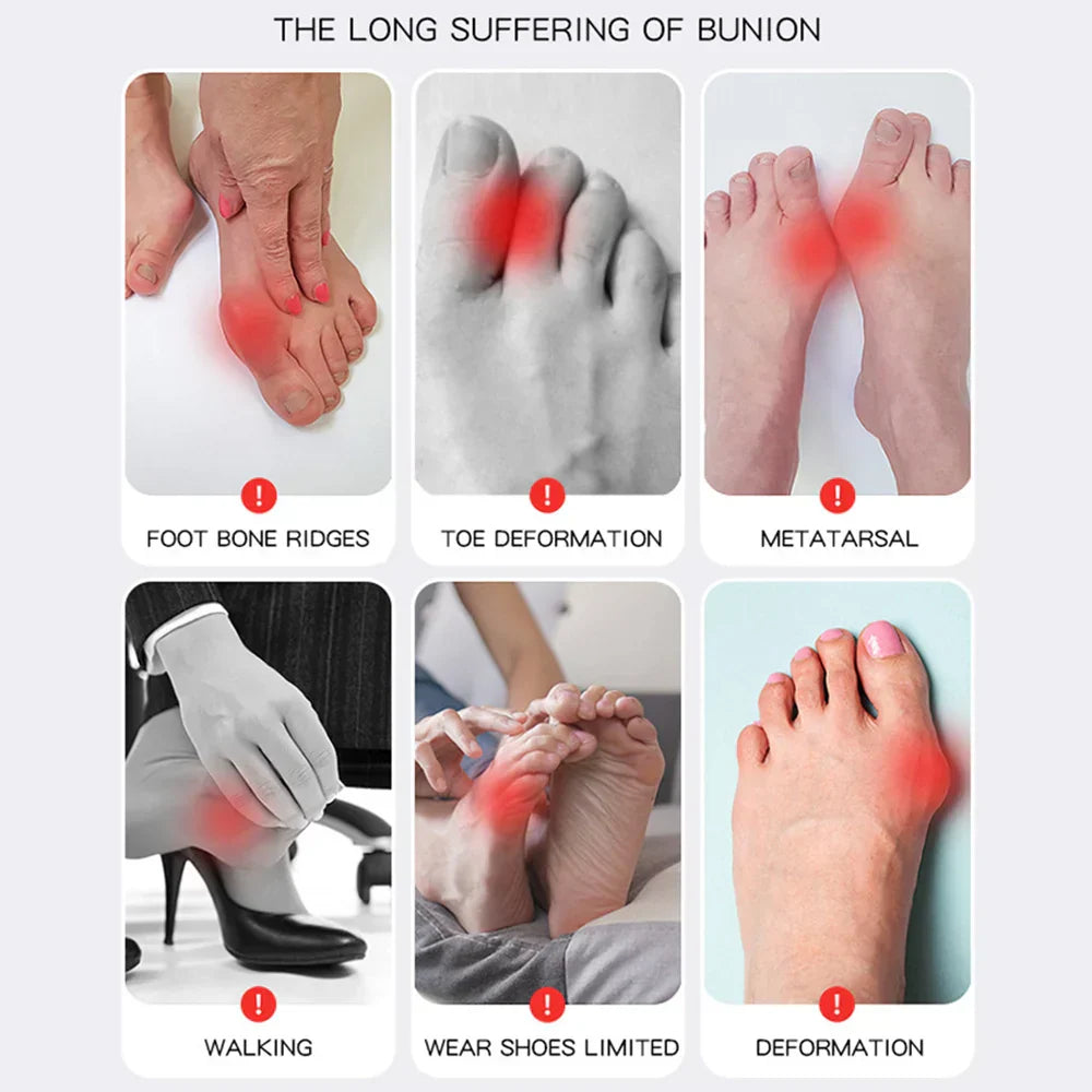 1+1 GRATIS | Hallux Valgus® | Zehenbegradiger