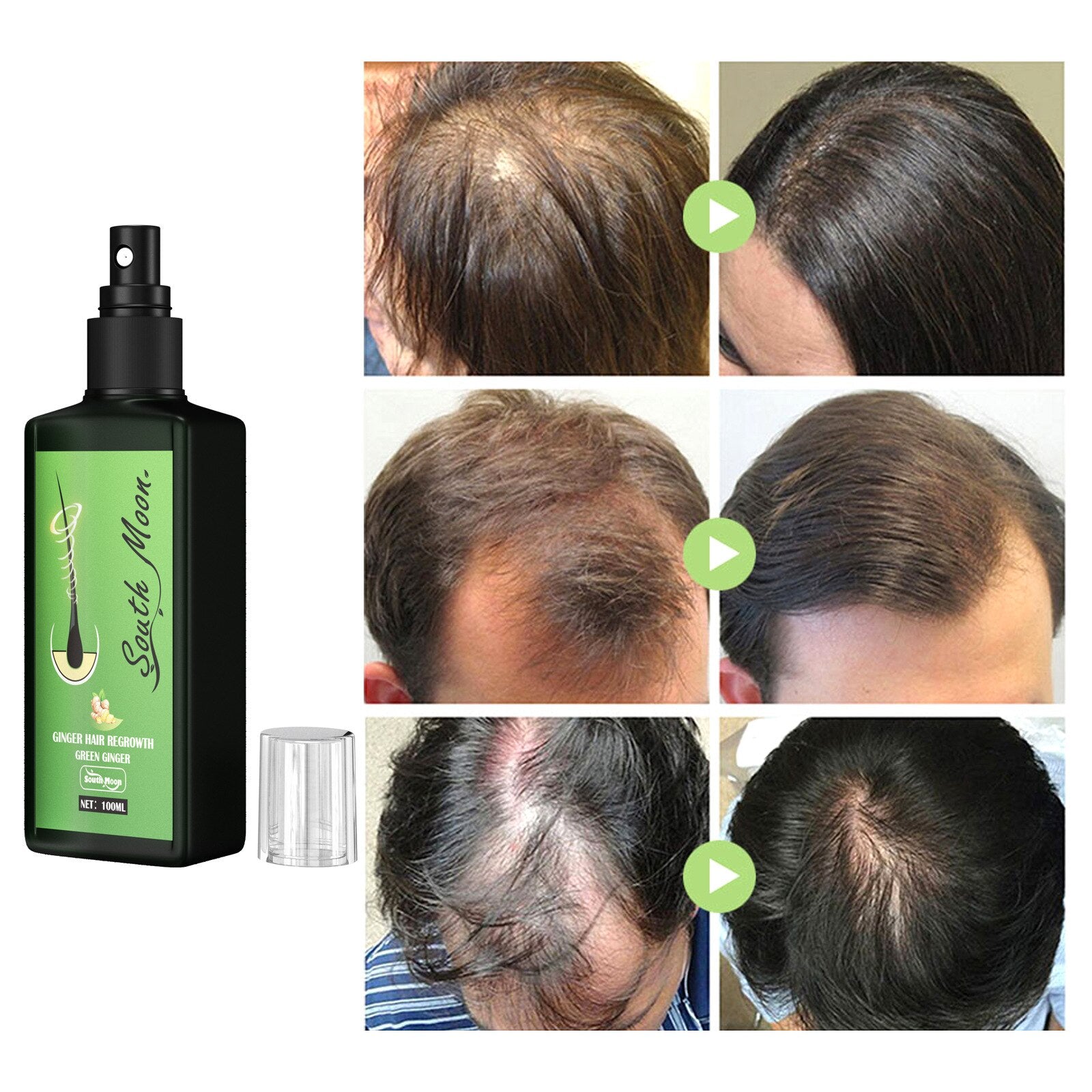 GrowthPlus™ - Pflegendes Ingwer-Spray