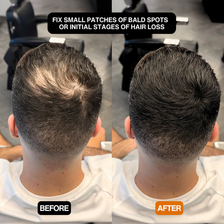 1+1 GRATIS | EdgeGuard™ | Eine schnelle Lösung für einen natürlichen, voluminösen Haaransatz!