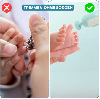 TinyTrim™ - Schützt empfindliche Finger