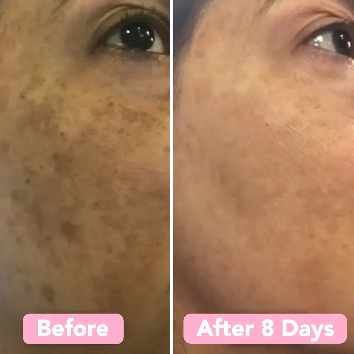 Turmiclear™ | Kurkuma & Kojic schäumende Reinigungsflüssigkeit
