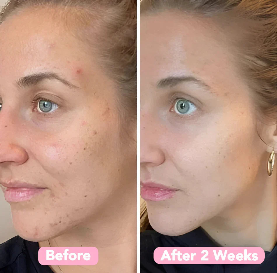 Turmiclear™ | Kurkuma & Kojic schäumende Reinigungsflüssigkeit
