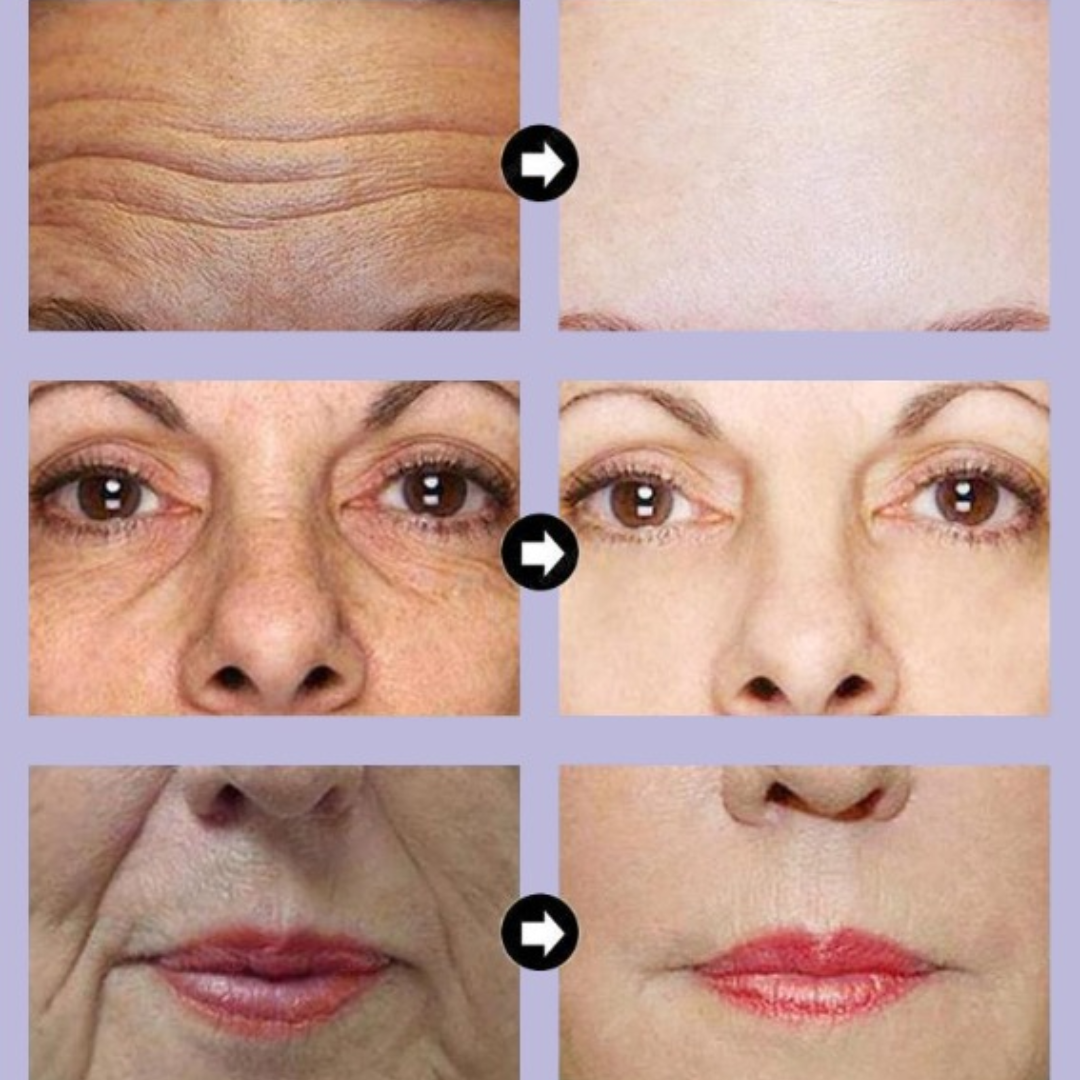 1+1 GRATIS | Slibridge™ | Anti-Falten-Gesichtsessenz