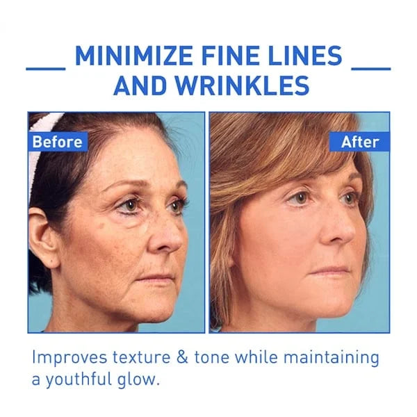 1+1 GRATIS | GlowTox™ | Glatte, jugendliche Haut mit Botox Anti-Aging Serum