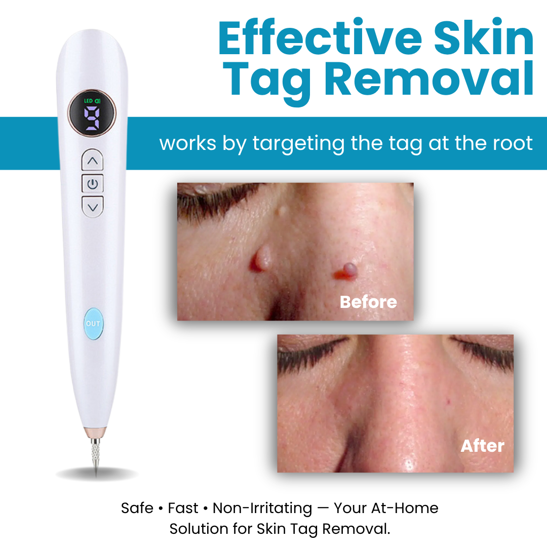 Gentiva™ | CO2-Laser für den Hausgebrauch Shot Erase Pro