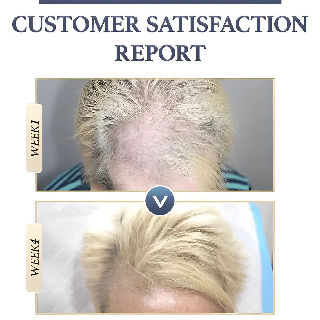 1+1 GRATIS | RegrowBar™ | Anti-Haarausfall
