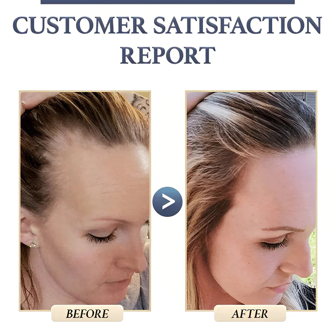 1+1 GRATIS | RegrowBar™ | Anti-Haarausfall