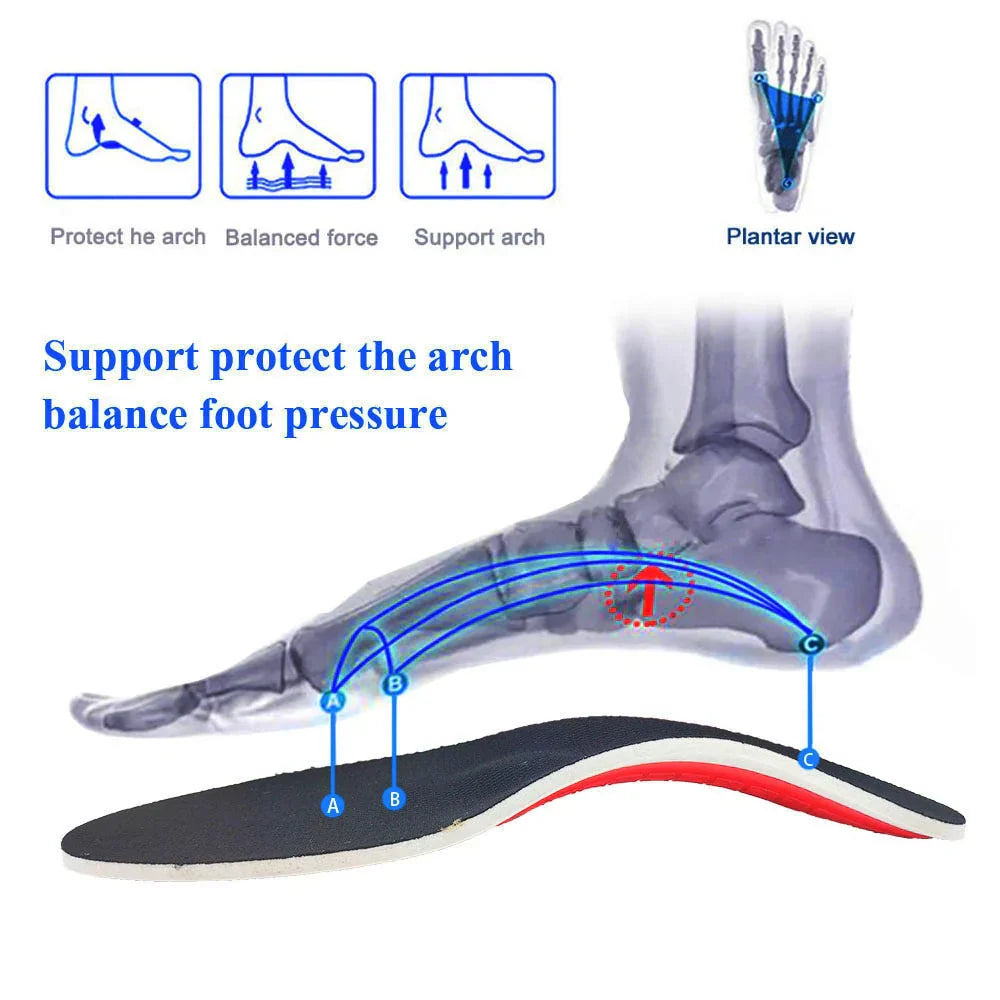 1+1 GRATIS | ArchEase™ - Orthopädische Fußgewölbeunterstützung