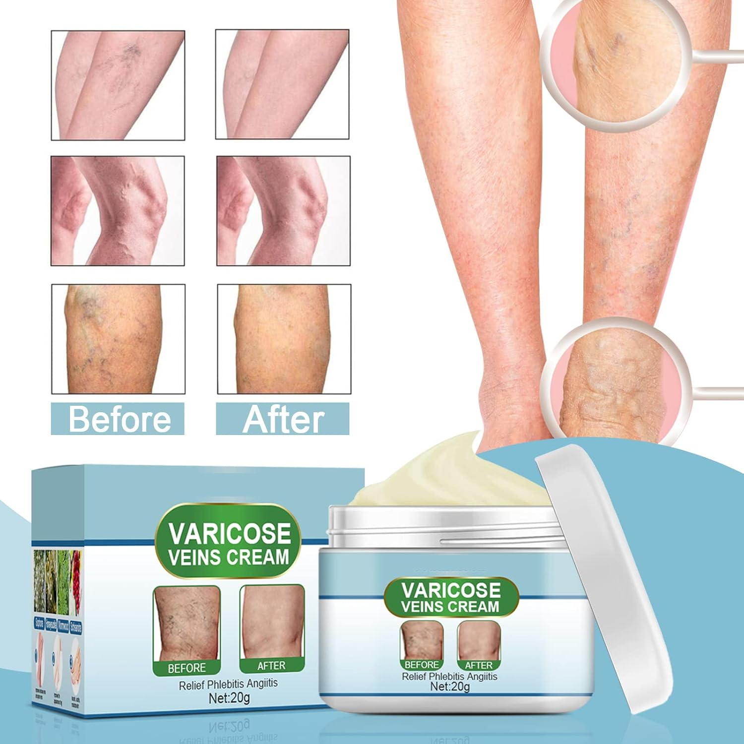 50% RABATT | VeinEase™ | Glättet und Beruhigt Müde Beine