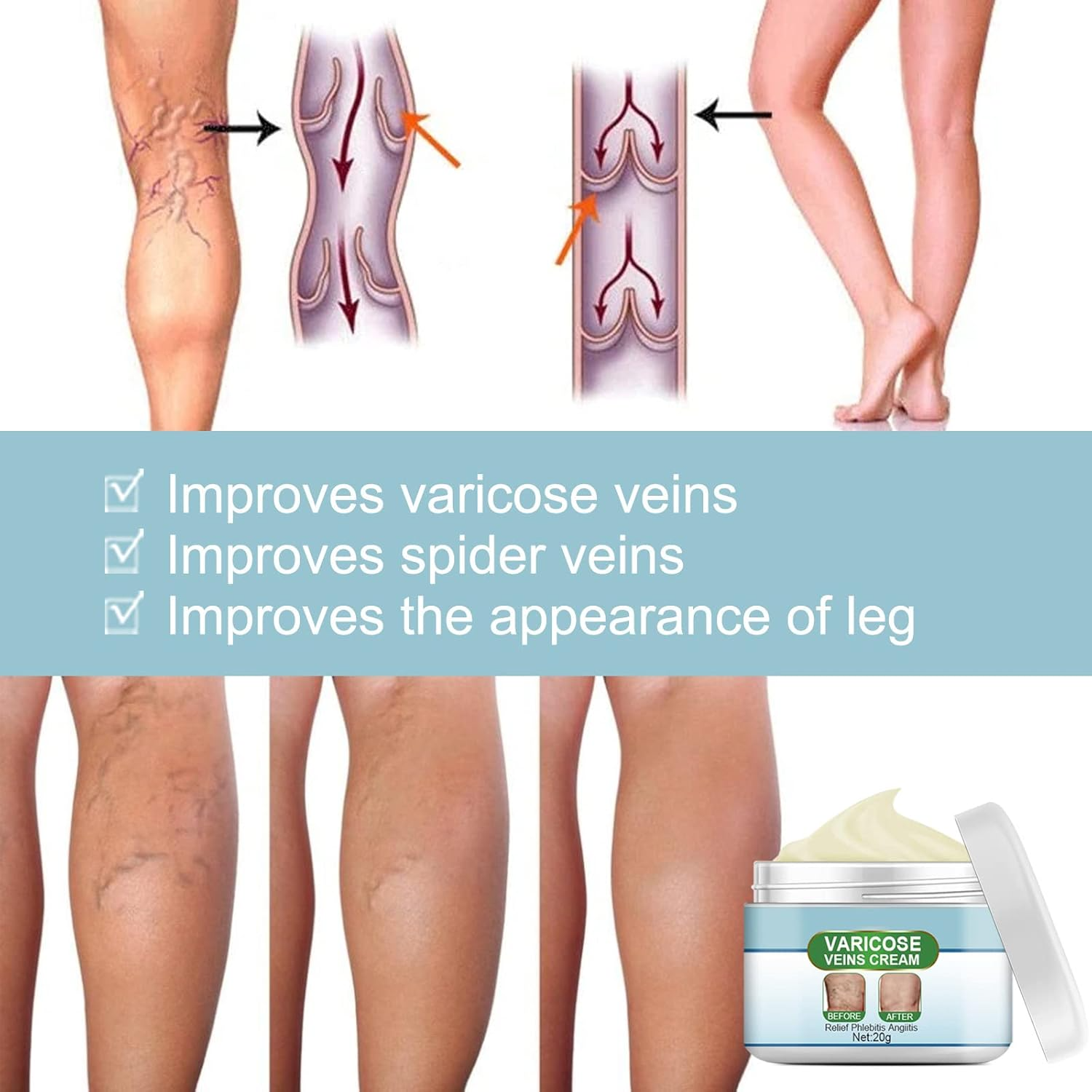50% RABATT | VeinEase™ | Glättet und Beruhigt Müde Beine